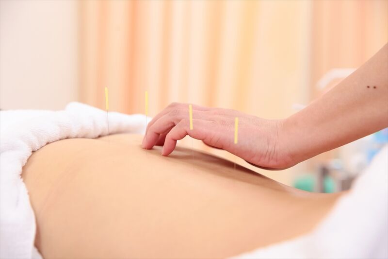 安全・確実な鍼灸治療